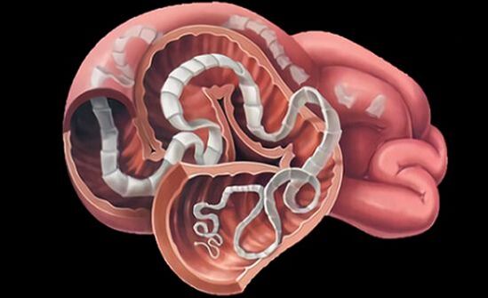 Parassiti nell'intestino